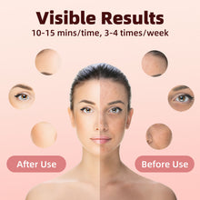 Load image into Gallery viewer, LED Face Mask, Light Therapy, Red Light Therapy Face Mask, 7 Colours, LED Face Mask with Red Light Therapy for All Skin Types, Face Care, Home Use, Travel Use, Black